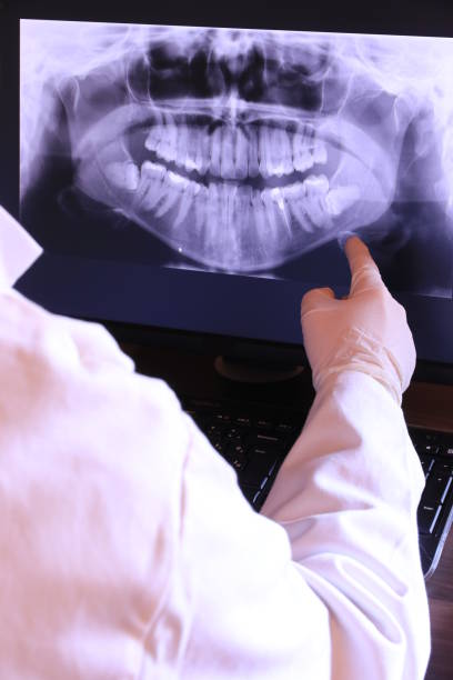 Best Emergency Treatment for Dental Infections or Abscesses in Brevard, NC