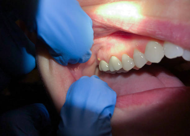 Best After-Hours Dental Trauma Care in Brevard, NC